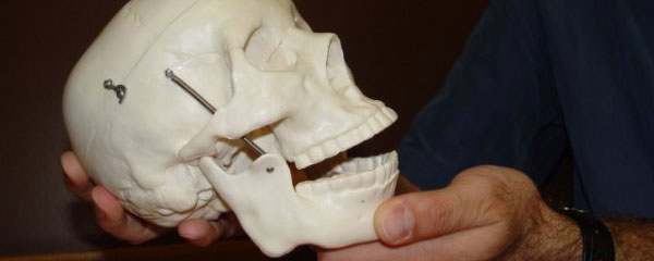 fisioterapia témporo-mandibular 